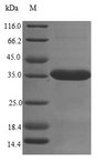 SUSD4 Protein - (Tris-Glycine gel) Discontinuous SDS-PAGE (reduced) with 5% enrichment gel and 15% separation gel.