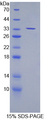 SUV420H2 Protein - Recombinant Suppressor Of Variegation 4-20 Homolog 2 By SDS-PAGE