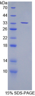 SUV420H2 Protein - Recombinant Suppressor Of Variegation 4-20 Homolog 2 By SDS-PAGE