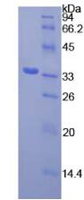 SYK Protein - Recombinant Spleen Tyrosine Kinase By SDS-PAGE