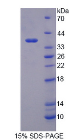 SYN1 / Synapsin 1 Protein - Recombinant Synapsin I By SDS-PAGE