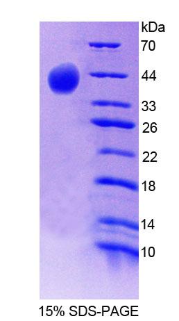 SYN2 / Synapsin II Protein - Recombinant Synapsin II (SYN2) by SDS-PAGE