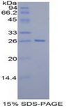 TAZ Protein - Recombinant Tafazzin By SDS-PAGE