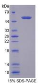 TDP1 Protein - Recombinant Tyrosyl DNA Phosphodiesterase 1 (TDP1) by SDS-PAGE