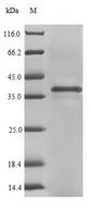 TECTB Protein - (Tris-Glycine gel) Discontinuous SDS-PAGE (reduced) with 5% enrichment gel and 15% separation gel.