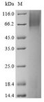 TEM7 Protein - (Tris-Glycine gel) Discontinuous SDS-PAGE (reduced) with 5% enrichment gel and 15% separation gel.