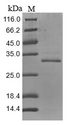 Tenascin Protein - (Tris-Glycine gel) Discontinuous SDS-PAGE (reduced) with 5% enrichment gel and 15% separation gel.