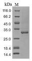 Tenascin Protein - (Tris-Glycine gel) Discontinuous SDS-PAGE (reduced) with 5% enrichment gel and 15% separation gel.