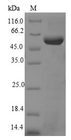 TERT / Telomerase Protein - (Tris-Glycine gel) Discontinuous SDS-PAGE (reduced) with 5% enrichment gel and 15% separation gel.