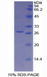 TFPI2 Protein - Recombinant Tissue Factor Pathway Inhibitor 2 By SDS-PAGE