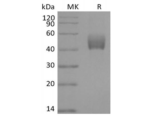TGFBR1 / ALK5 Protein - Recombinant Mouse ALK-5/TGFBR1 (C-Fc)