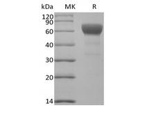 TGFBR2 Protein - Recombinant Mouse Transforming Growth Factor-Beta Receptor Type II/TGFBR2 (C-Fc)