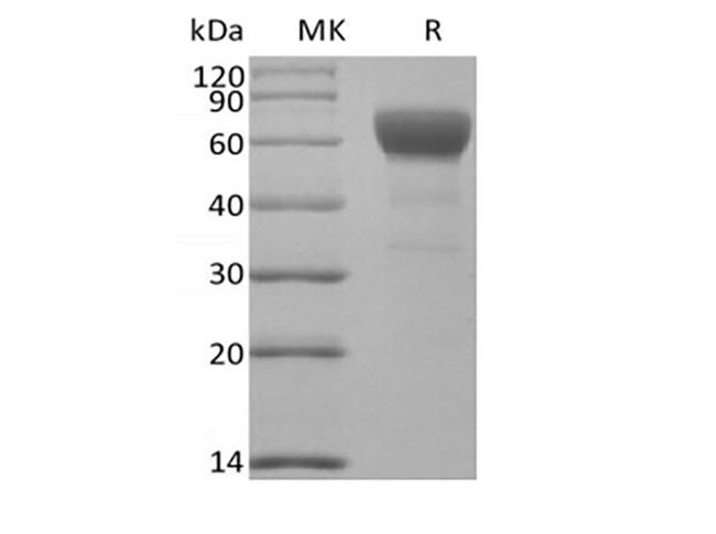 TGFBR2 Protein - Recombinant Mouse Transforming Growth Factor-Beta Receptor Type II/TGFBR2 (C-Fc)