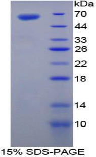 TGM1 / Transglutaminase Protein - Recombinant Transglutaminase 1, Keratinocyte By SDS-PAGE