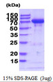 TGM2 / Transglutaminase 2 Protein