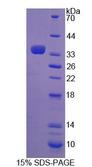 TGM3 / Transglutaminase 3 Protein - Recombinant Transglutaminase 3, Epidermal By SDS-PAGE