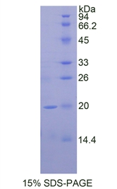 THBS1 / Thrombospondin-1 Protein - Recombinant Thrombospondin 1 By SDS-PAGE