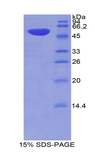 THBS2 / Thrombospondin 2 Protein - Recombinant Thrombospondin 2 By SDS-PAGE
