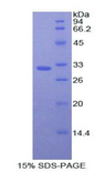 THPO / TPO / Thrombopoietin Protein - Recombinant Thrombopoietin (TPO) by SDS-PAGE