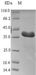 THRSP Protein - (Tris-Glycine gel) Discontinuous SDS-PAGE (reduced) with 5% enrichment gel and 15% separation gel.