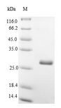 THY1 / CD90 Protein - (Tris-Glycine gel) Discontinuous SDS-PAGE (reduced) with 5% enrichment gel and 15% separation gel.