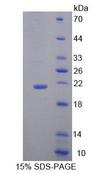 Thymidylate Kinase Protein - Recombinant Deoxythymidylate Kinase (DTYMK) by SDS-PAGE