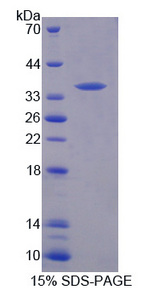 TIE1 / TIE Protein - Recombinant Tyrosine Kinase With ImMunoglobulin Like And EGF Like Domains Protein 1 By SDS-PAGE