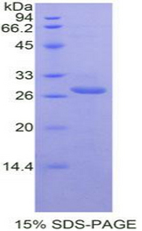 TIGIT Protein - Recombinant T-Cell Immunoreceptor With Ig And ITIM Domains Protein By SDS-PAGE