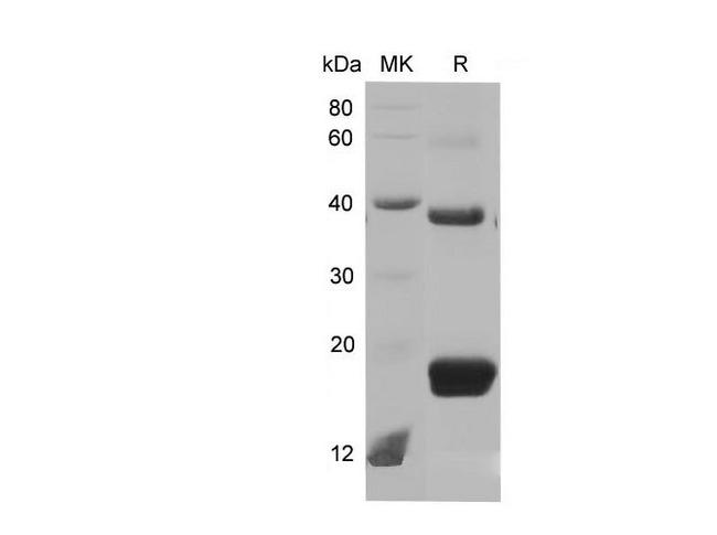 TIMP1 Protein - Recombinant Mouse TIMP1 Protein (His Tag)-Elabscience