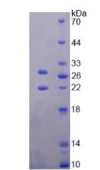 TIMP3 Protein - Recombinant Tissue Inhibitors Of Metalloproteinase 3 By SDS-PAGE