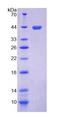 TLR1 Protein - Recombinant Toll Like Receptor 1 By SDS-PAGE