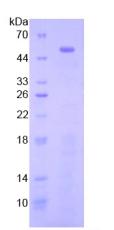 TLR3 Protein - Recombinant Toll Like Receptor 3 By SDS-PAGE