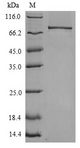 TLR4 Protein - (Tris-Glycine gel) Discontinuous SDS-PAGE (reduced) with 5% enrichment gel and 15% separation gel.