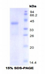 TLR4 Protein - Recombinant Toll Like Receptor 4 By SDS-PAGE