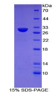 TLR6 Protein - Recombinant Toll Like Receptor 6 By SDS-PAGE