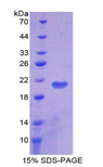 TLR7 / CD287 Protein - Recombinant Toll Like Receptor 7 By SDS-PAGE