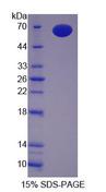 TLR9 Protein - Recombinant Toll Like Receptor 9 By SDS-PAGE