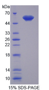 TMEFF1 / Tomoregulin 1 Protein - Recombinant Tomoregulin 1 By SDS-PAGE