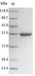 TMEM27 / Collectrin Protein - (Tris-Glycine gel) Discontinuous SDS-PAGE (reduced) with 5% enrichment gel and 15% separation gel.