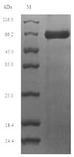 TMPRSS15 / Enterokinase Protein - (Tris-Glycine gel) Discontinuous SDS-PAGE (reduced) with 5% enrichment gel and 15% separation gel.