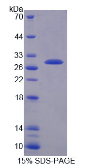 TMPRSS2 / Epitheliasin Protein - Recombinant Transmembrane Protease, Serine 2 By SDS-PAGE