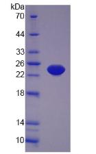 TNF Alpha Protein - Active Tumor Necrosis Factor Alpha (TNFa) by SDS-PAGE