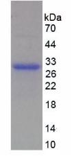TNFRSF14 / CD270 / HVEM Protein - Recombinant Tumor Necrosis Factor Receptor Superfamily, Member 14 By SDS-PAGE