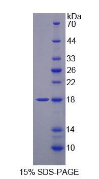 TNFRSF17 / BCMA Protein - Recombinant Tumor Necrosis Factor Receptor Superfamily, Member 17 By SDS-PAGE