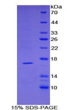 TNFRSF19L / RELT Protein - Recombinant Tumor Necrosis Factor Receptor Superfamily, Member 19 Like Protein By SDS-PAGE
