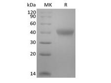 TNFRSF1B / TNFR2 Protein - Recombinant Mouse TNF Receptor II/TNF RII/TNFRSF1B/CD120b (C-6His-Avi) Biotinylated