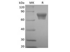 TNFRSF1B / TNFR2 Protein - Recombinant Mouse TNF Receptor II/TNF RII/TNFRSF1B/CD120b (C-Fc)