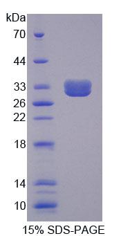 TNFRSF1B / TNFR2 Protein - Recombinant Tumor Necrosis Factor Receptor Superfamily, Member 1B By SDS-PAGE