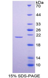 TNFRSF4 / CD134 / OX40 Protein - Recombinant Tumor Necrosis Factor Receptor Superfamily, Member 4 By SDS-PAGE