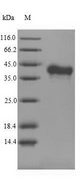 TNFSF11 / RANKL / TRANCE Protein - (Tris-Glycine gel) Discontinuous SDS-PAGE (reduced) with 5% enrichment gel and 15% separation gel.